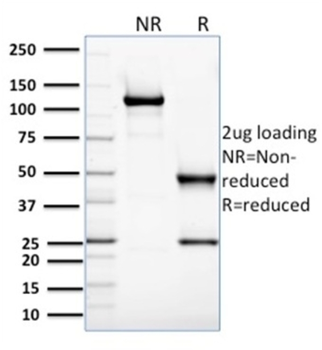 GLO1 Antibody