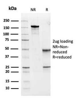 MSH6 Antibody