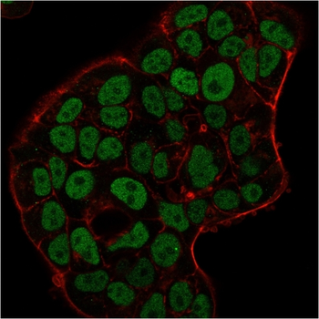 MSH6 Antibody