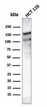 MSH6 Antibody