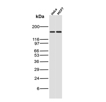 MSH6 Antibody