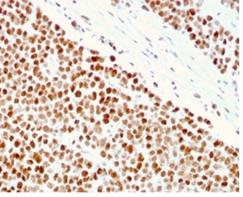 MSH6 Antibody