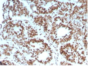 MSH6 Antibody