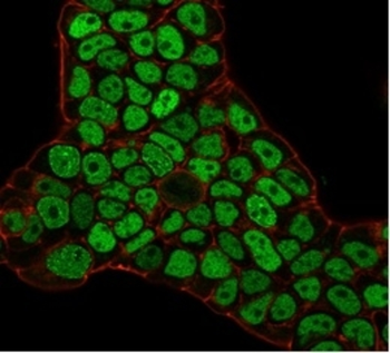 MSH6 Antibody