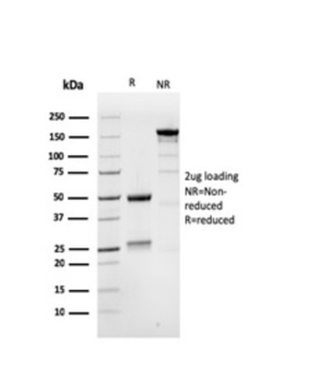 MSH6 Antibody