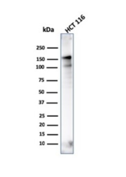 MSH6 Antibody