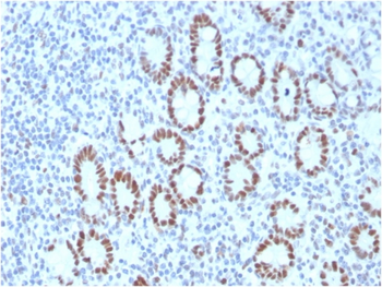 MSH6 Antibody