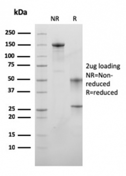 MSH6 Antibody
