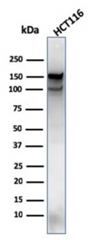 MSH6 Antibody