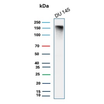 MSH6 Antibody