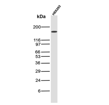 MSH6 Antibody