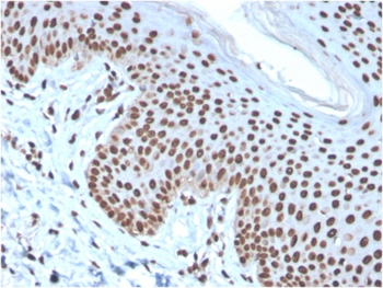 H1-0, N/A Antibody