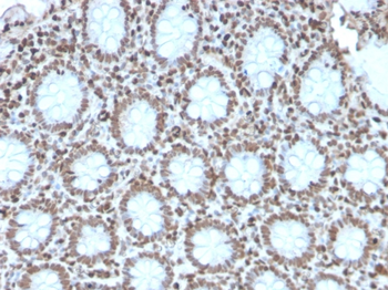 H1-0, N/A Antibody