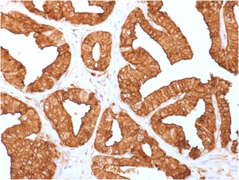 ANXA1 Antibody