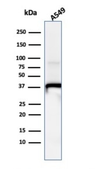 ANXA1 Antibody