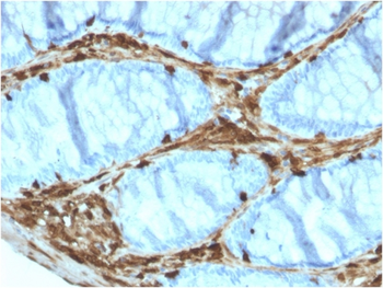 ANXA1 Antibody