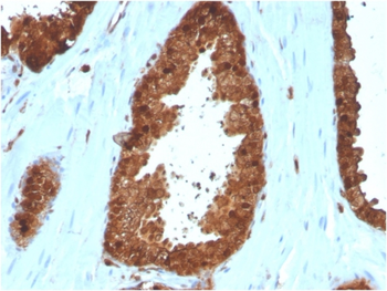 ANXA1 Antibody