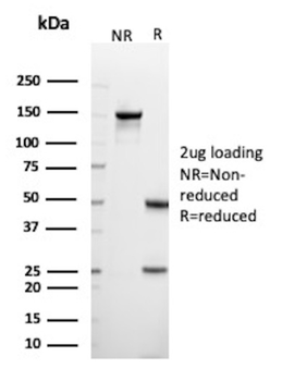 HLA-DRB1 Antibody