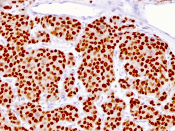 FOXA1 Antibody