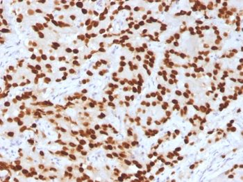 FOXA1 Antibody