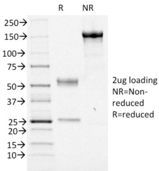 FOXA1 Antibody