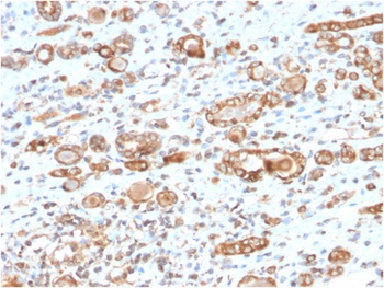 HSPD1 Antibody