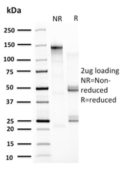 HSPD1 Antibody