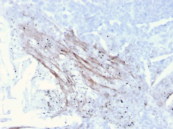 TNC Antibody