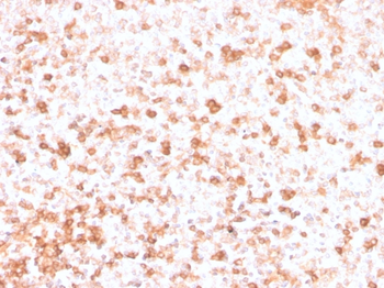 IGLV1-51 Antibody