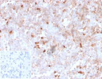 IGLV1-51 Antibody