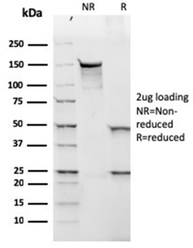 IGLV1-51 Antibody