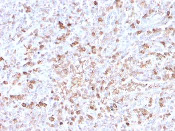 IGLV1-51 Antibody
