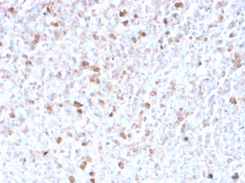 IGLV1-51 Antibody