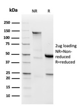 IGLV1-51 Antibody
