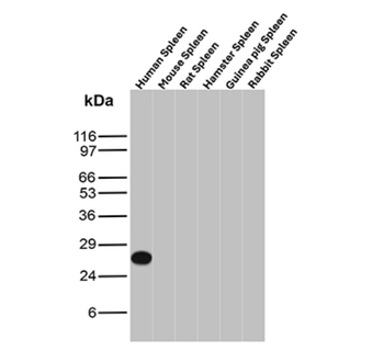 IGLV1-51 Antibody