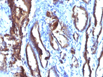 KLK3 Antibody
