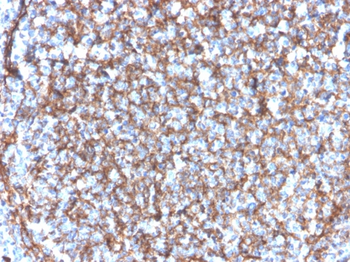 ITGAM Antibody