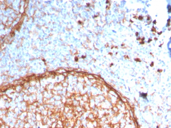 ITGAM Antibody