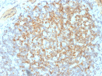 ITGB3 Antibody