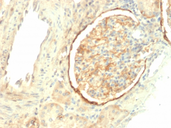 ITGB3 Antibody