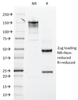 ITGB3 Antibody