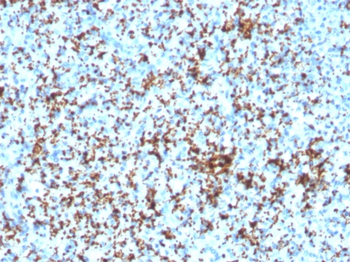 ITGB3 Antibody
