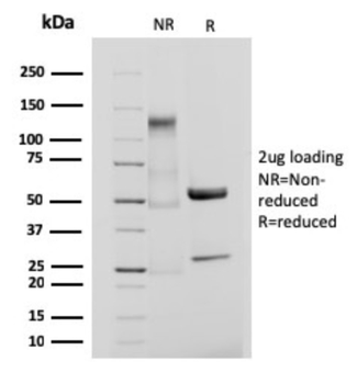 ITGB3 Antibody