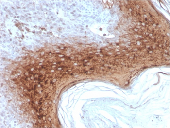 IVL Antibody