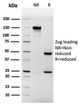 IVL Antibody