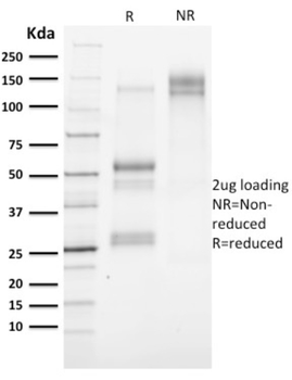 KRT3 Antibody