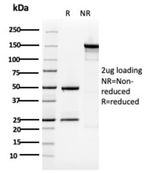 KRT5 Antibody