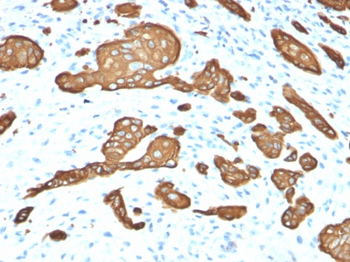 KRT8 Antibody
