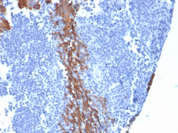 KRT13 Antibody