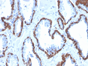 KRT13 Antibody